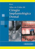 ATLAS EN COLOR DE CIRUGIA IMPLANTALOGICA DENTAL