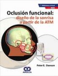 OCLUSION FUNCIONAL: DISEÑO DE LA SONRISA A PARTIR DE LA ATM
