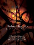 Electocardiograma y arritmias